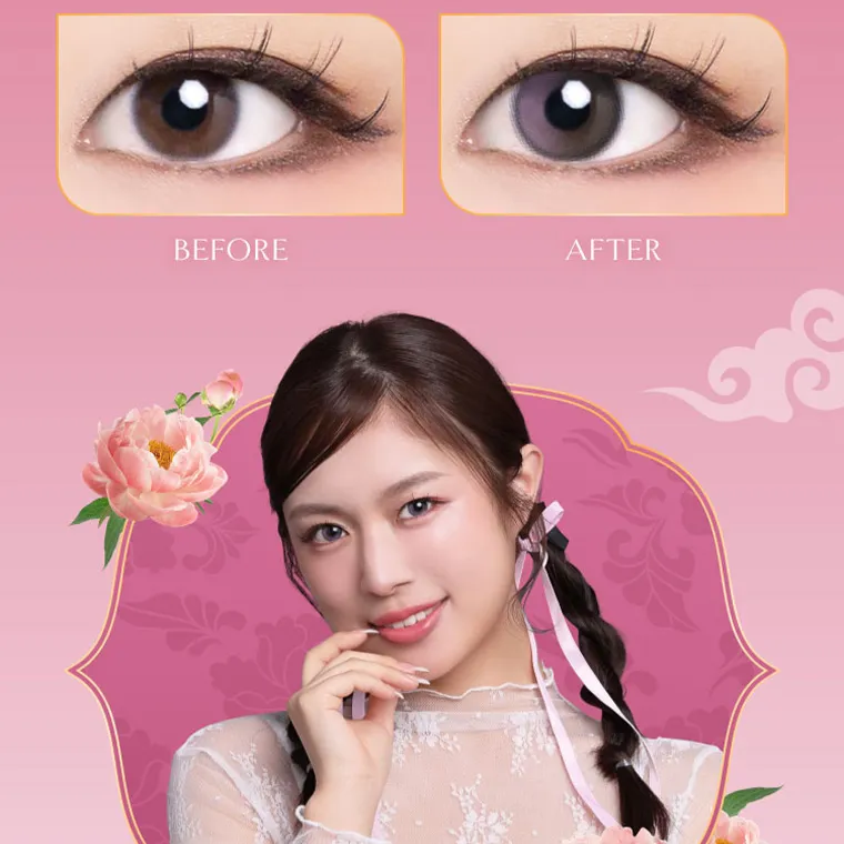  villege -ヴィレジェ｜BEFORE AFTER